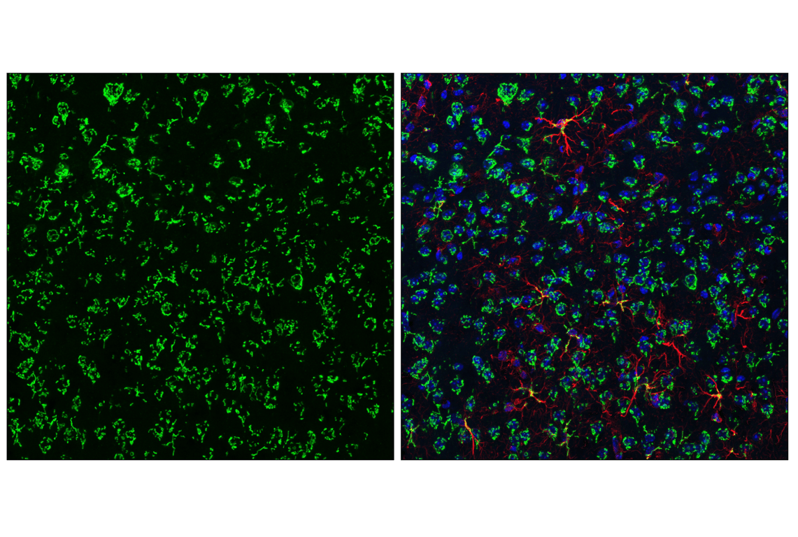 Immunofluorescence Image 3: GM130 (E9Z6S) Rabbit Monoclonal Antibody