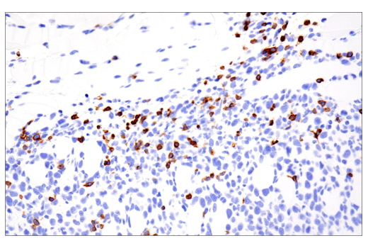 Immunohistochemistry Image 2: CD3 epsilon (E4T1B) Rabbit Monoclonal Antibody (BSA and Azide Free)