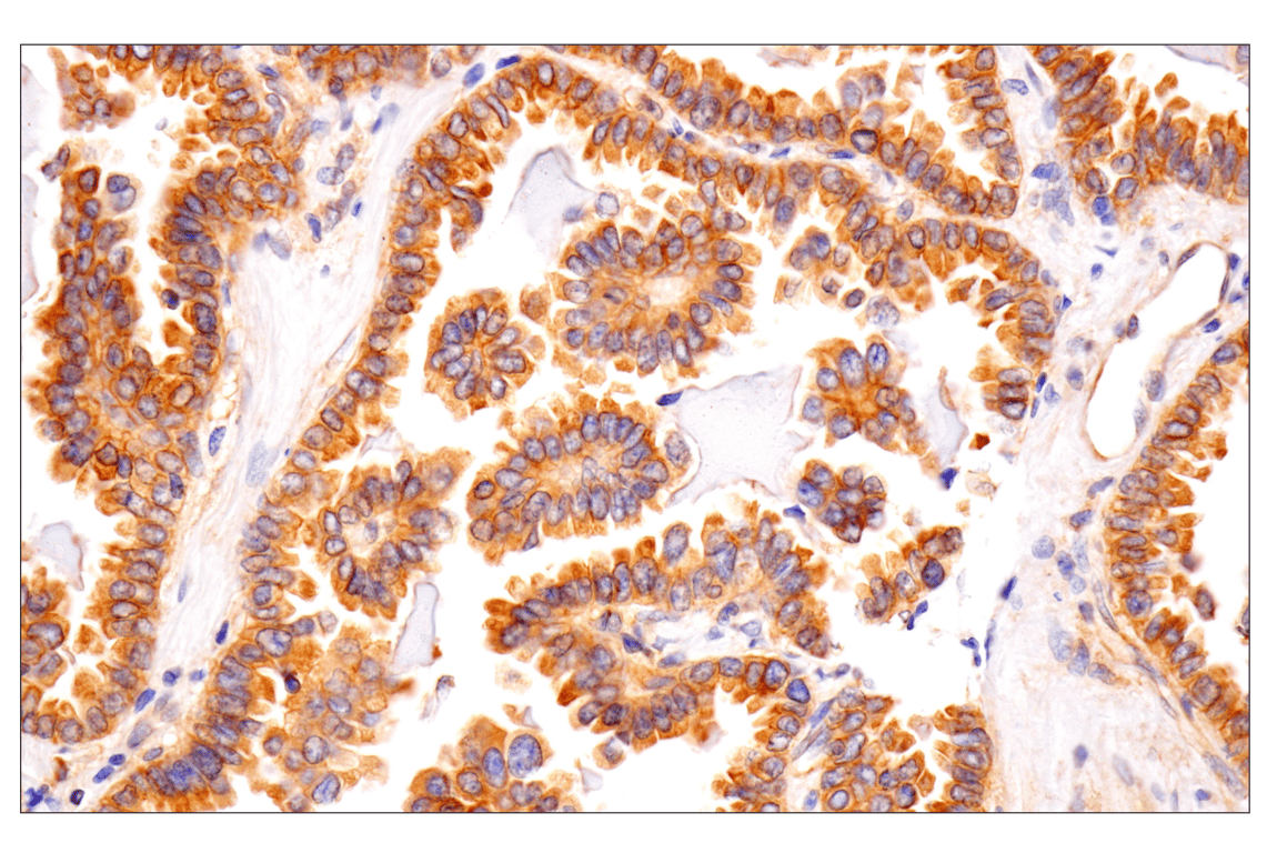 Immunohistochemistry Image 2: Numb (F2P3P) Rabbit Monoclonal Antibody