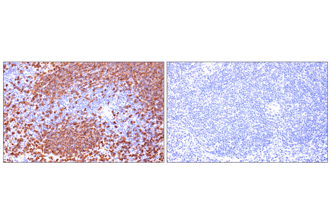 Immunohistochemistry Image 8: CD79A (F3Z1H) Rabbit Monoclonal Antibody
