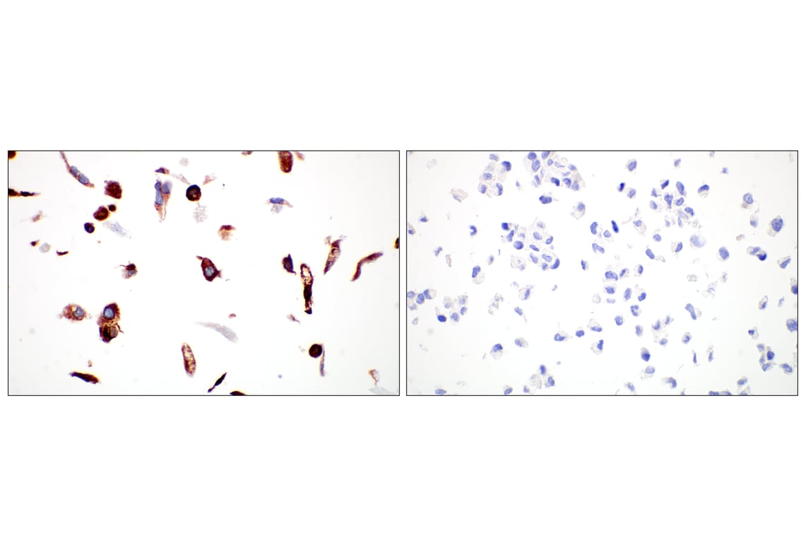Immunohistochemistry Image 7: LPCAT1 (E4V4B) Rabbit Monoclonal Antibody (BSA and Azide Free)