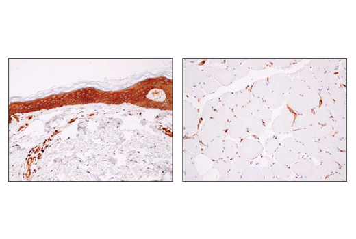 Immunohistochemistry Image 3: alpha-Actinin 4 (D7U5A) Rabbit Monoclonal Antibody 