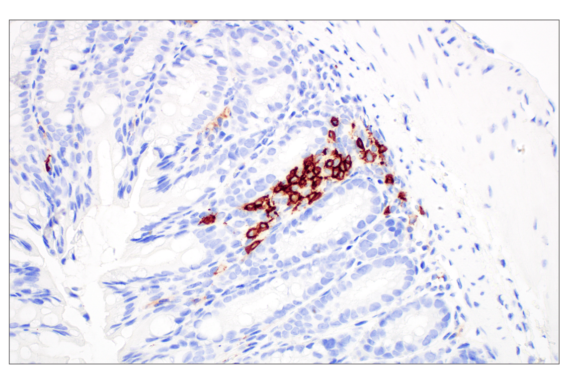 Immunohistochemistry Image 2: CD20 (E3N7O) Rabbit Monoclonal Antibody