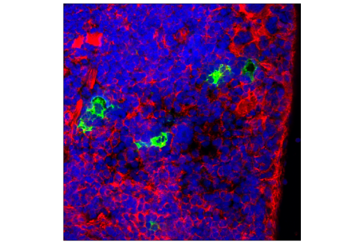 Immunofluorescence Image 1: PD-1 (Intracellular Domain) (D7D5W) Rabbit Monoclonal Antibody (BSA and Azide Free)