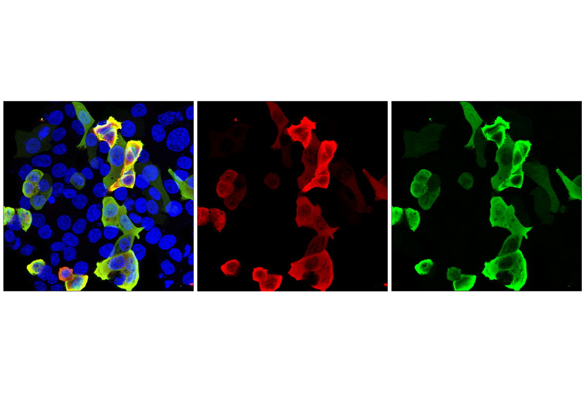 Immunofluorescence Image 1: HA-Tag (E1R3B) Mouse Monoclonal Antibody