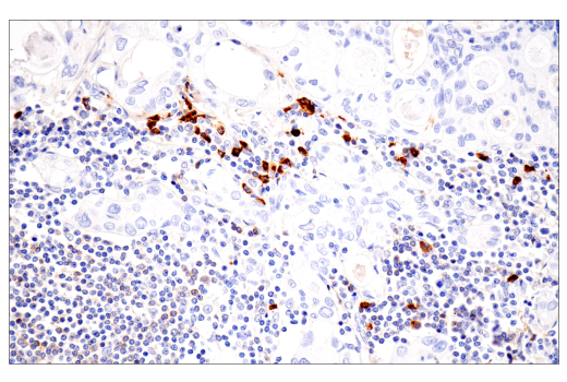 Immunohistochemistry Image 8: IgA (N1CLA) Mouse Monoclonal Antibody