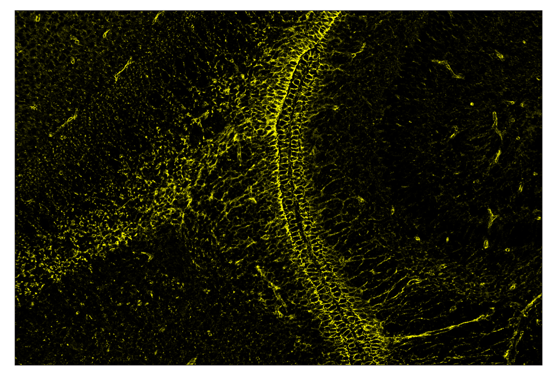 Immunohistochemistry Image 2: beta-Catenin (D10A8) & CO-0108-750 SignalStar<sup>™</sup> Oligo-Antibody Pair