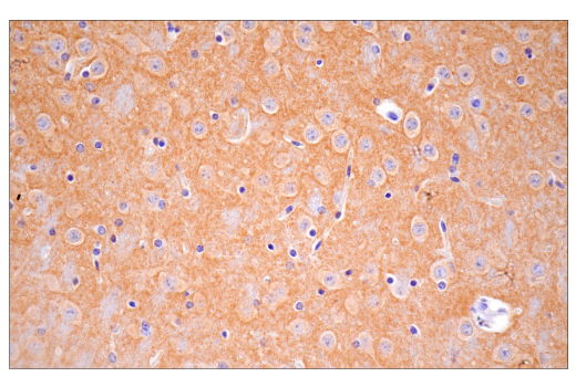 Immunohistochemistry Image 1: SynGAP-alpha2 (E4Y6I) Rabbit Monoclonal Antibody