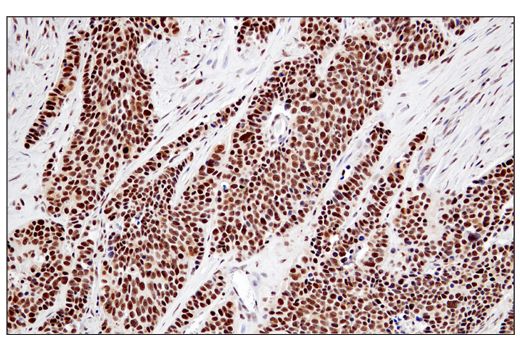 Immunohistochemistry Image 1: RPA32/RPA2 (E8X5P) XP<sup>®</sup> Rabbit mAb