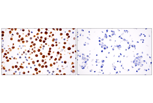 Immunohistochemistry Image 13: Calretinin (E7R6O) Rabbit Monoclonal Antibody