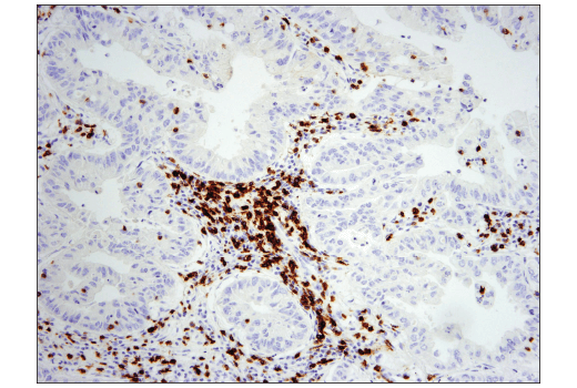 Immunohistochemistry Image 1: CD5 (E8X3S) Rabbit Monoclonal Antibody (BSA and Azide Free)