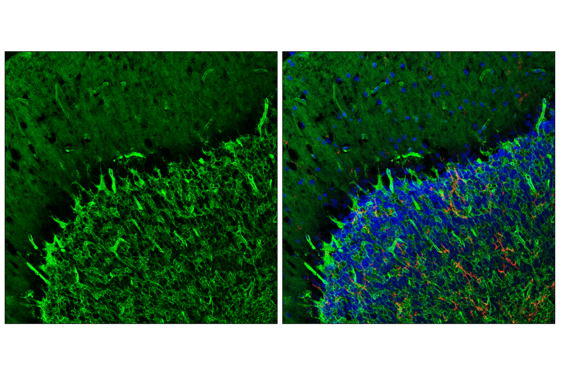 Immunofluorescence Image 1: AQP4 (E4B6T) Mouse Monoclonal Antibody