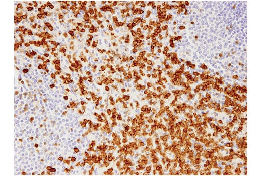 Immunohistochemistry Image 4: Annexin A1 (D5V2T) Rabbit Monoclonal Antibody (BSA and Azide Free)