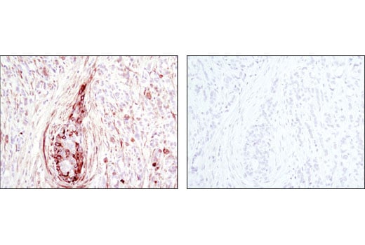 Immunohistochemistry Image 1: Phospho-HSP27 (Ser82) (D1H2F6) Rabbit Monoclonal Antibody (BSA and Azide Free)