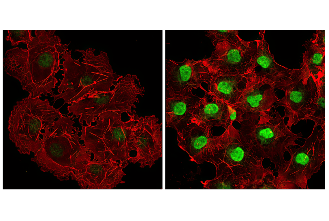 undefined Image 31: Angiogenesis Antibody Sampler Kit