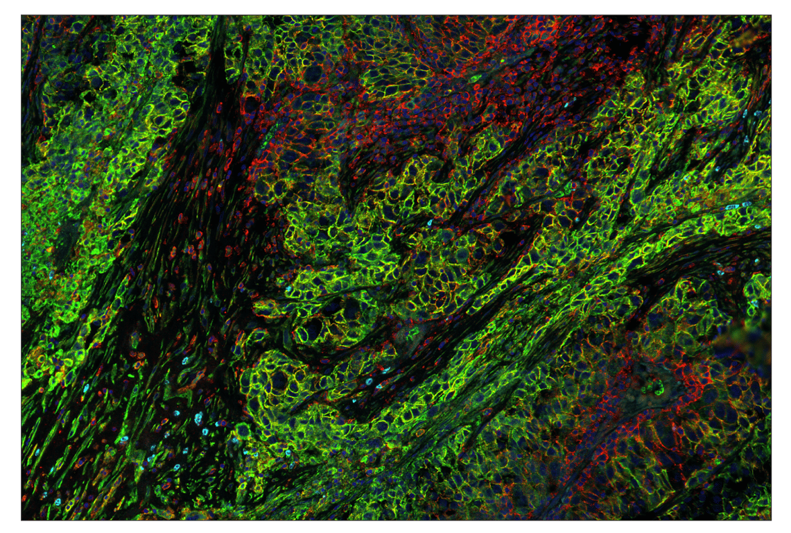 Immunohistochemistry Image 1: Glut1 (E4S6I) & CO-0192-647 SignalStar<sup>®</sup> Oligo-Antibody Pair