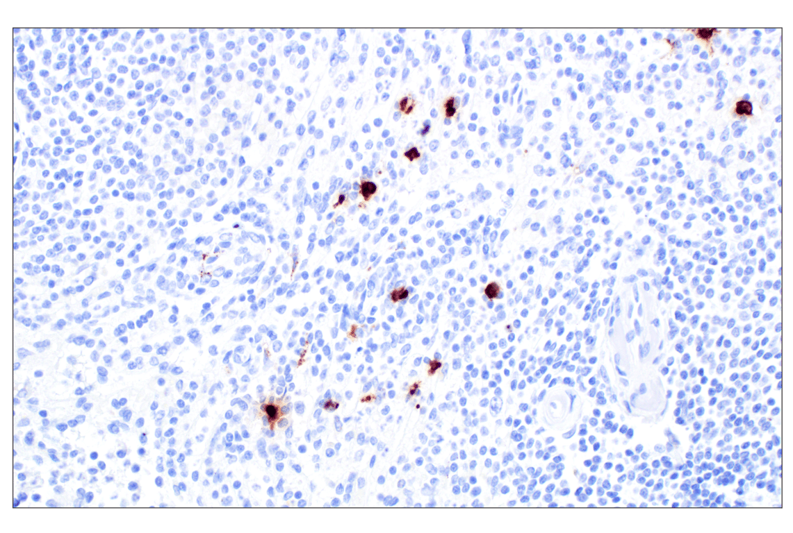 Immunohistochemistry Image 2: Eosinophil peroxidase (F3C2H) Rabbit Monoclonal Antibody