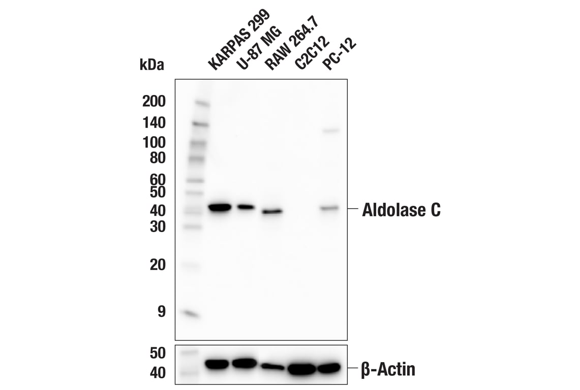 Western Blotting Image 2: Aldolase C (E7I4X) Rabbit Monoclonal Antibody