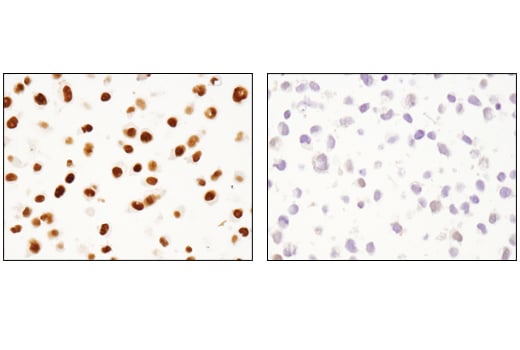 Immunohistochemistry Image 4: BRM (D9E8B) XP<sup>®</sup> Rabbit mAb