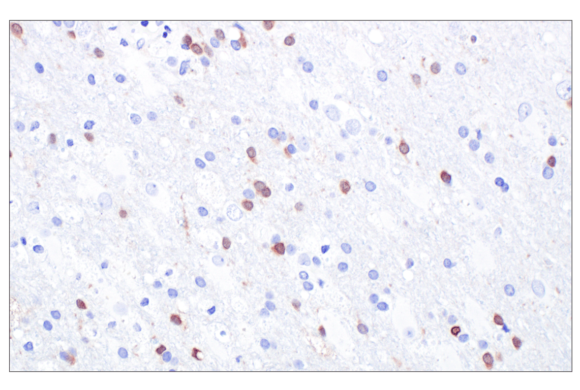 Immunohistochemistry Image 9: p16 INK4A (F9T1L) Rabbit Monoclonal Antibody