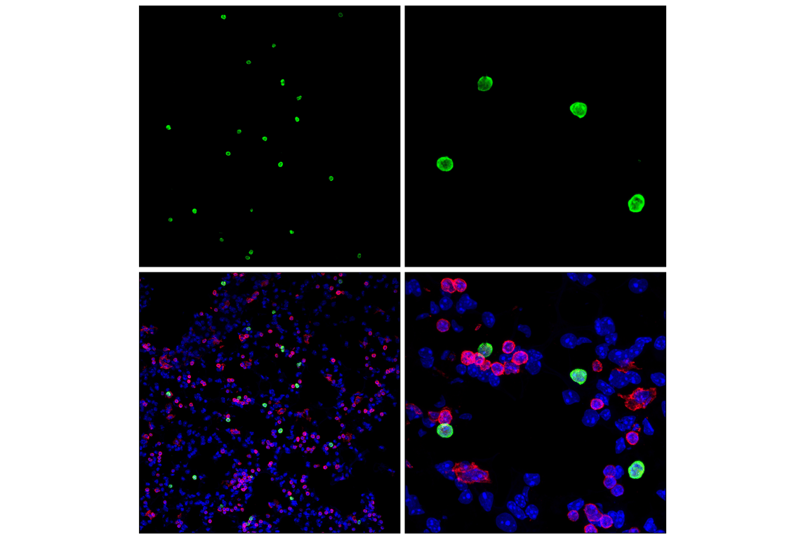 Immunofluorescence Image 2: S100A9 (D3U8M) Rabbit Monoclonal Antibody (Alexa Fluor<sup>®</sup> 488 Conjugate)