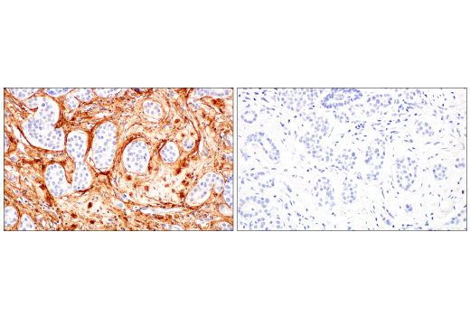Immunohistochemistry Image 7: Periostin (E5F2S) Rabbit Monoclonal Antibody (BSA and Azide Free)