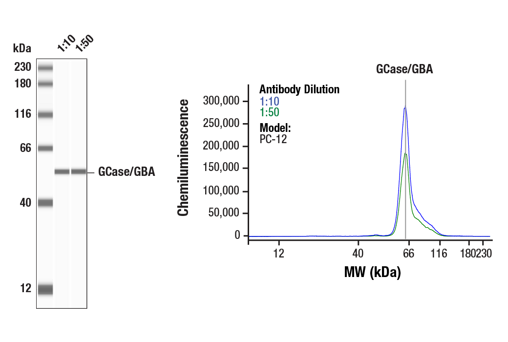 Western Blotting Image 1: GCase/GBA (E2R1L) Rabbit Monoclonal Antibody