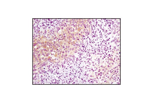 undefined Image 20: mTOR Regulation Antibody Sampler Kit