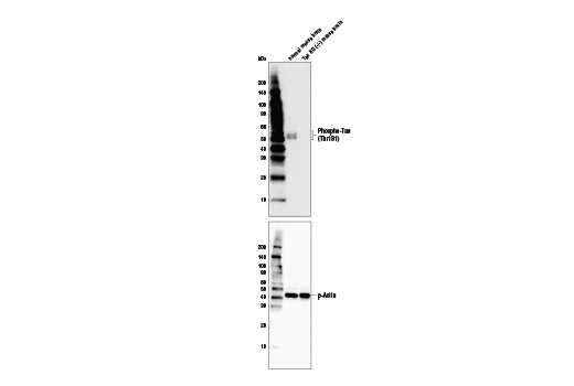 undefined Image 1: PhosphoPlus<sup>®</sup> Tau (Thr181) Antibody Duet