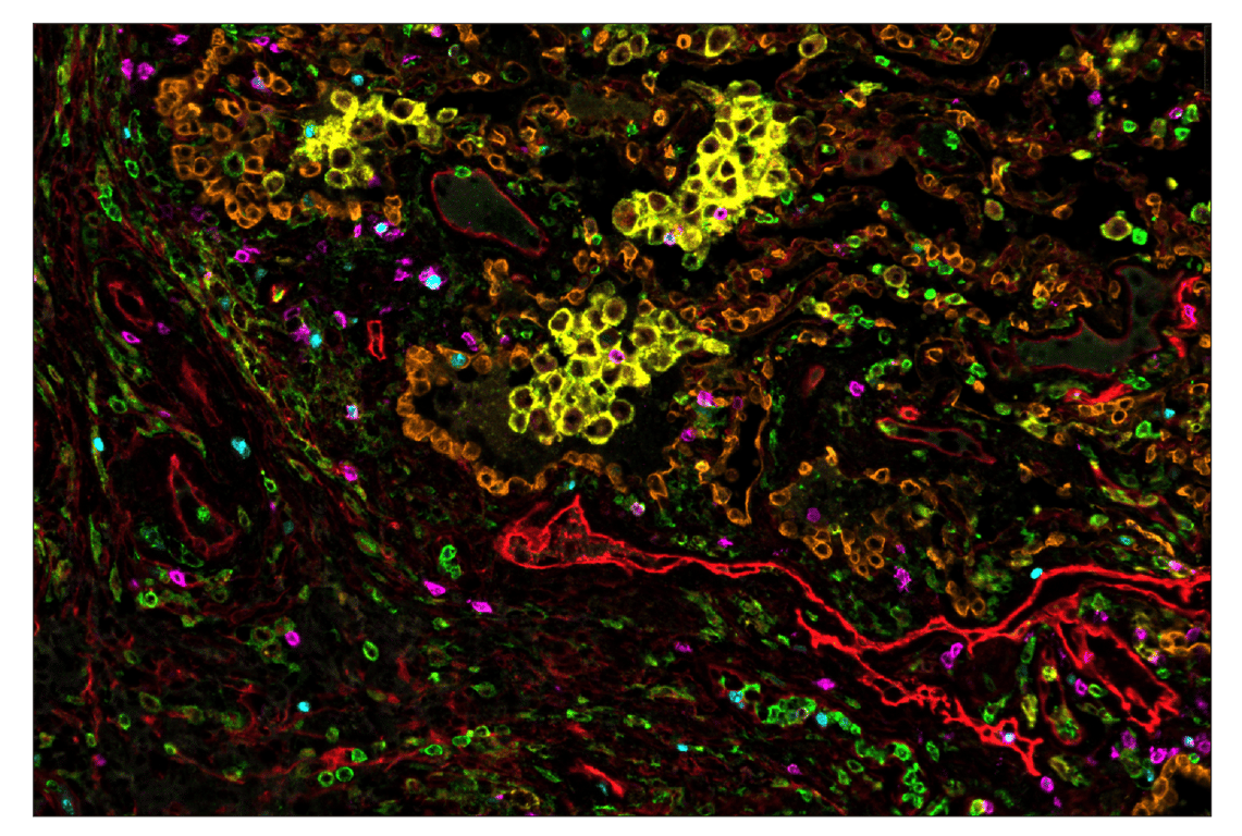 Immunohistochemistry Image 1: CD86 (E2G8P) & CO-0038-488 SignalStar<sup>™</sup> Oligo-Antibody Pair