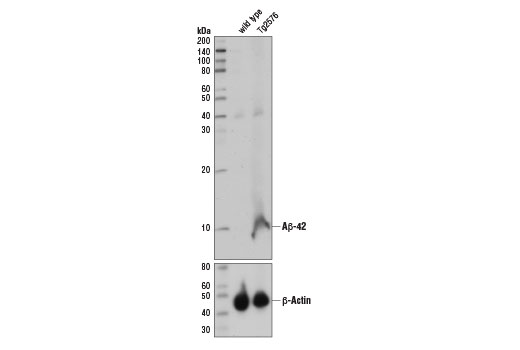 Western Blotting Image 2: beta-Amyloid (1-42) (D9A3A) Rabbit Monoclonal Antibody