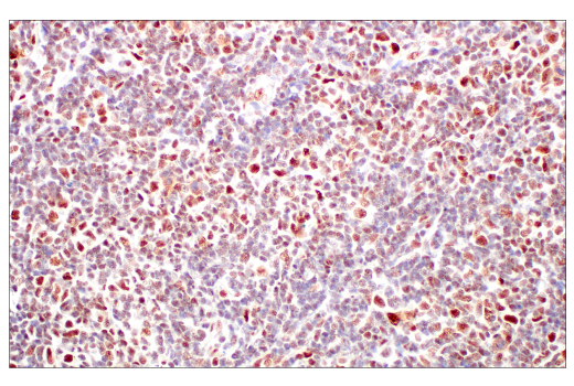 undefined Image 29: ATM Substrates Antibody Sampler Kit
