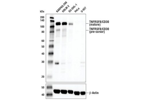 Western Blotting Image 2: TNFRSF8/CD30 (E1A6Y) Rabbit Monoclonal Antibody