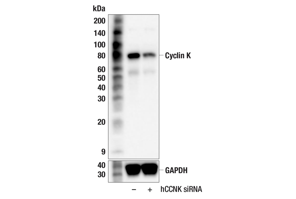 Western Blotting Image 2: Cyclin K (F1F2I) Rabbit Monoclonal Antibody