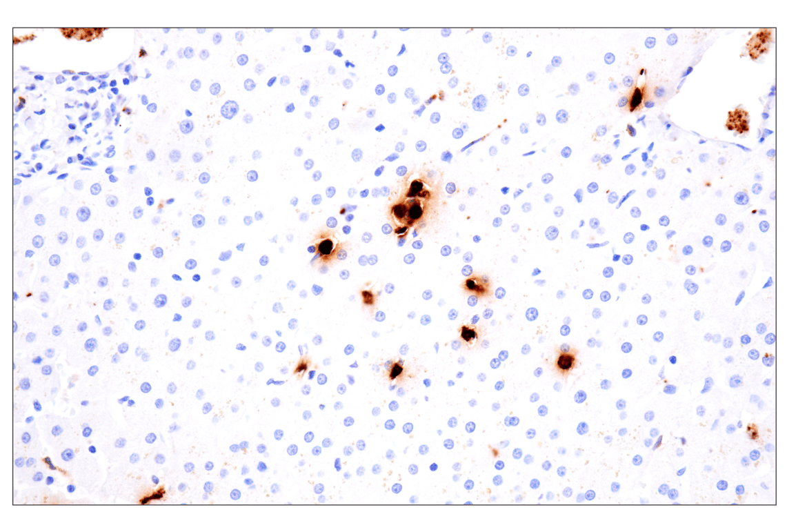 Immunohistochemistry Image 9: Neutrophil Elastase (F4H3X) Rabbit Monoclonal Antibody (BSA and Azide Free)