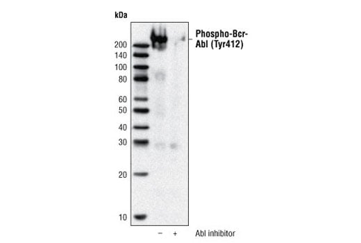 Western Blotting Image 2: Phospho-c-Abl (Tyr412) (247C7) Rabbit Monoclonal Antibody