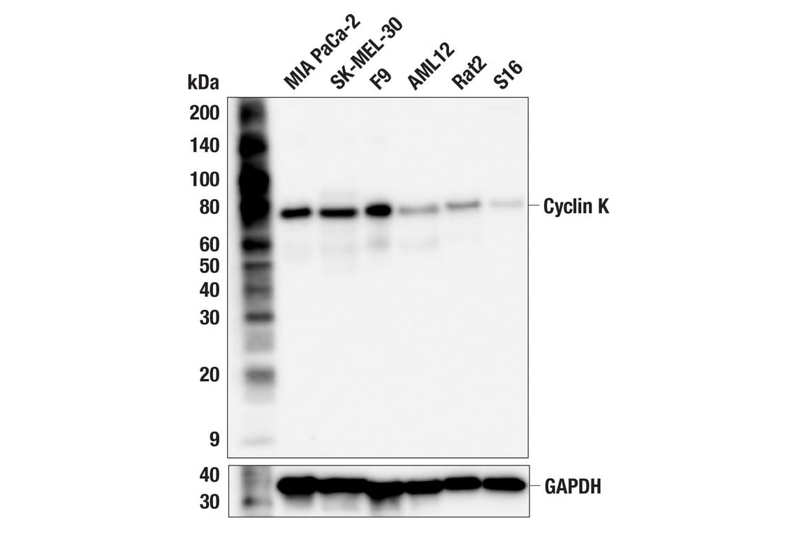 Western Blotting Image 3: Cyclin K (F1F2I) Rabbit Monoclonal Antibody