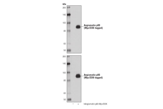 Western Blotting Image 2: Angiomotin (D2O4H) Rabbit Monoclonal Antibody