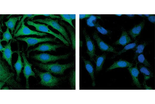 undefined Image 3: SignalSilence<sup>®</sup> GSK-3 alpha/beta siRNA