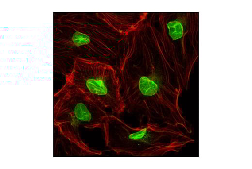 Immunofluorescence Image 1: NUP98 (C39A3) Rabbit Monoclonal Antibody