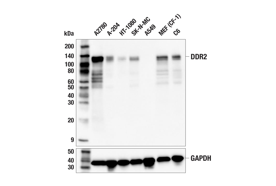 Western Blotting Image 2: DDR2 (E6V2N) Rabbit Monoclonal Antibody