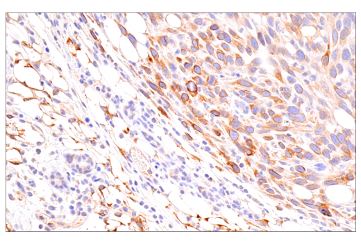 Immunohistochemistry Image 7: Cox2 (D5H5) Rabbit Monoclonal Antibody