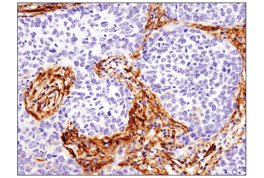 Immunohistochemistry Image 3: Podoplanin (LpMab-12) Mouse Monoclonal Antibody