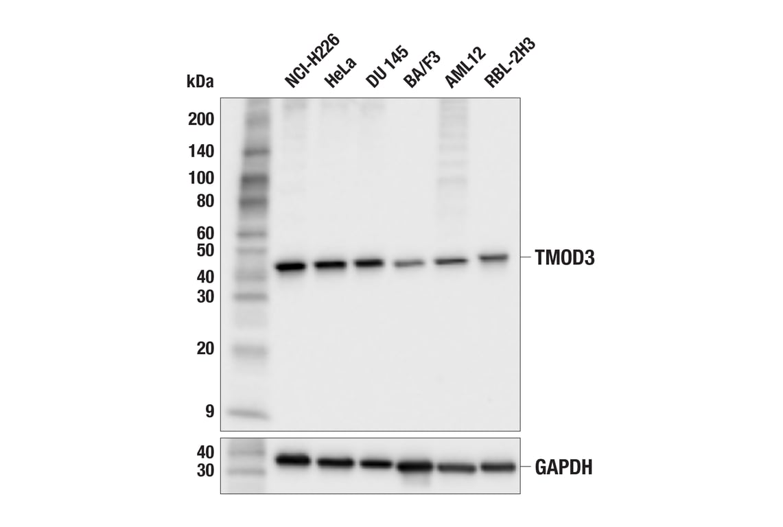 Western Blotting Image 2: TMOD3 (F9M4D) Rabbit Monoclonal Antibody