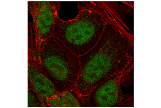 Immunofluorescence Image 1: TCF1/TCF7 (C63D9) Rabbit Monoclonal Antibody (BSA and Azide Free)