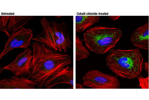 undefined Image 33: Mitophagy Antibody Sampler Kit