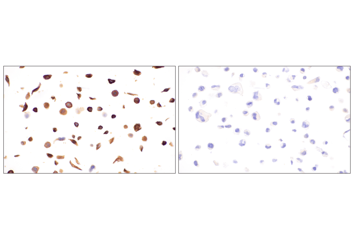 Immunohistochemistry Image 21: p75NTR (E7I3M) Rabbit Monoclonal Antibody (BSA and Azide Free)