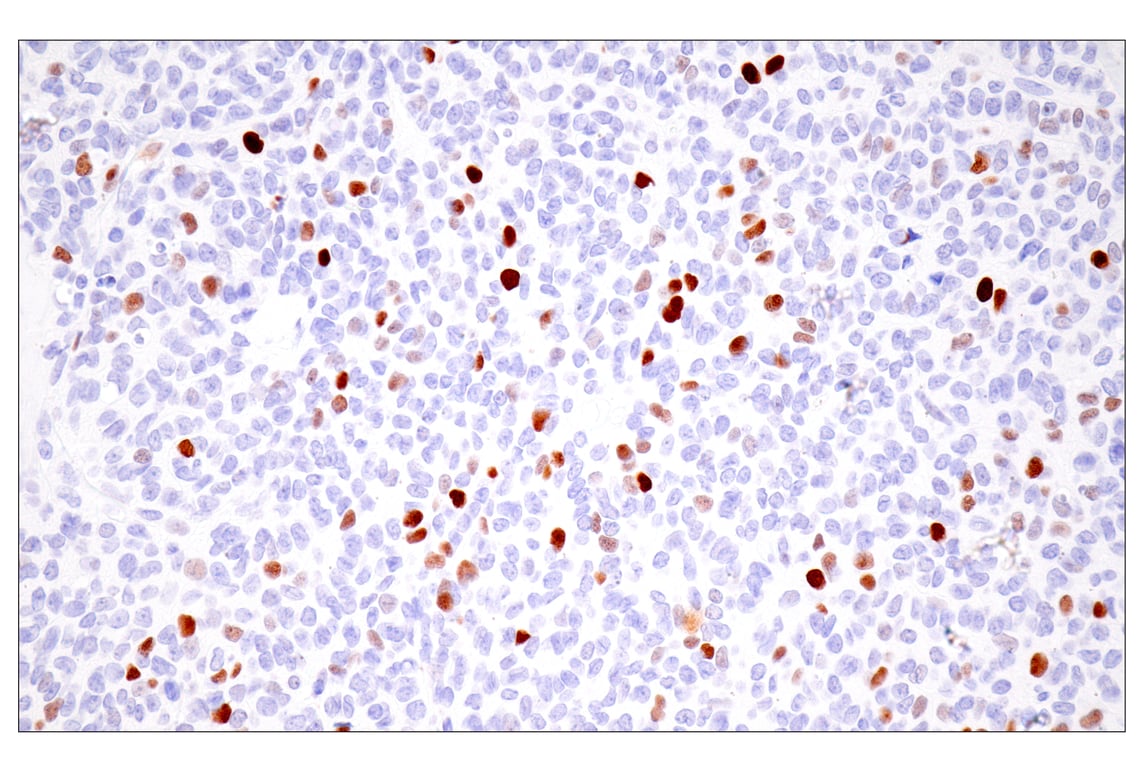 Immunohistochemistry Image 5: UHRF1 (E5W8W) Rabbit Monoclonal Antibody