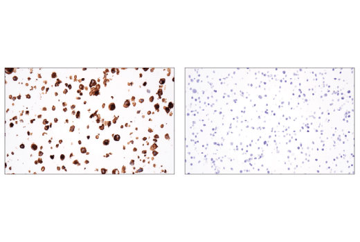 Immunohistochemistry Image 1: GITR (D5V7P) Rabbit Monoclonal Antibody (BSA and Azide Free)