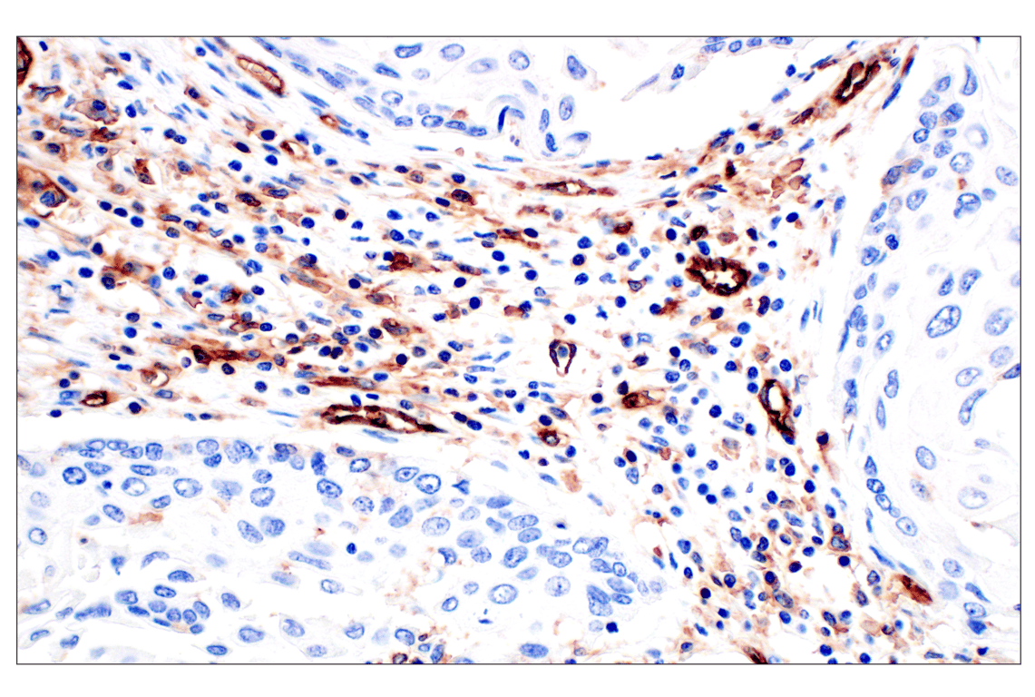 Immunohistochemistry Image 6: CD31 (PECAM-1) (F8M3S) Rabbit Monoclonal Antibody